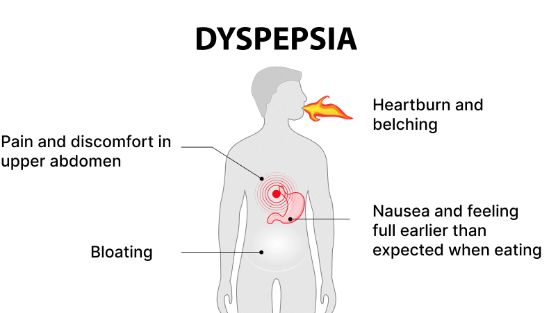 The Dyspepsia Inducing Actions